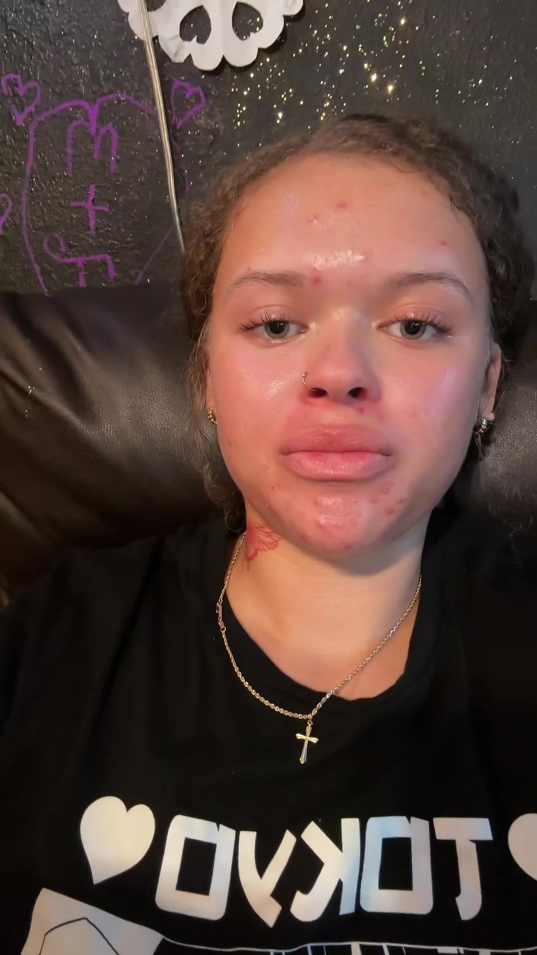 @shegotacne