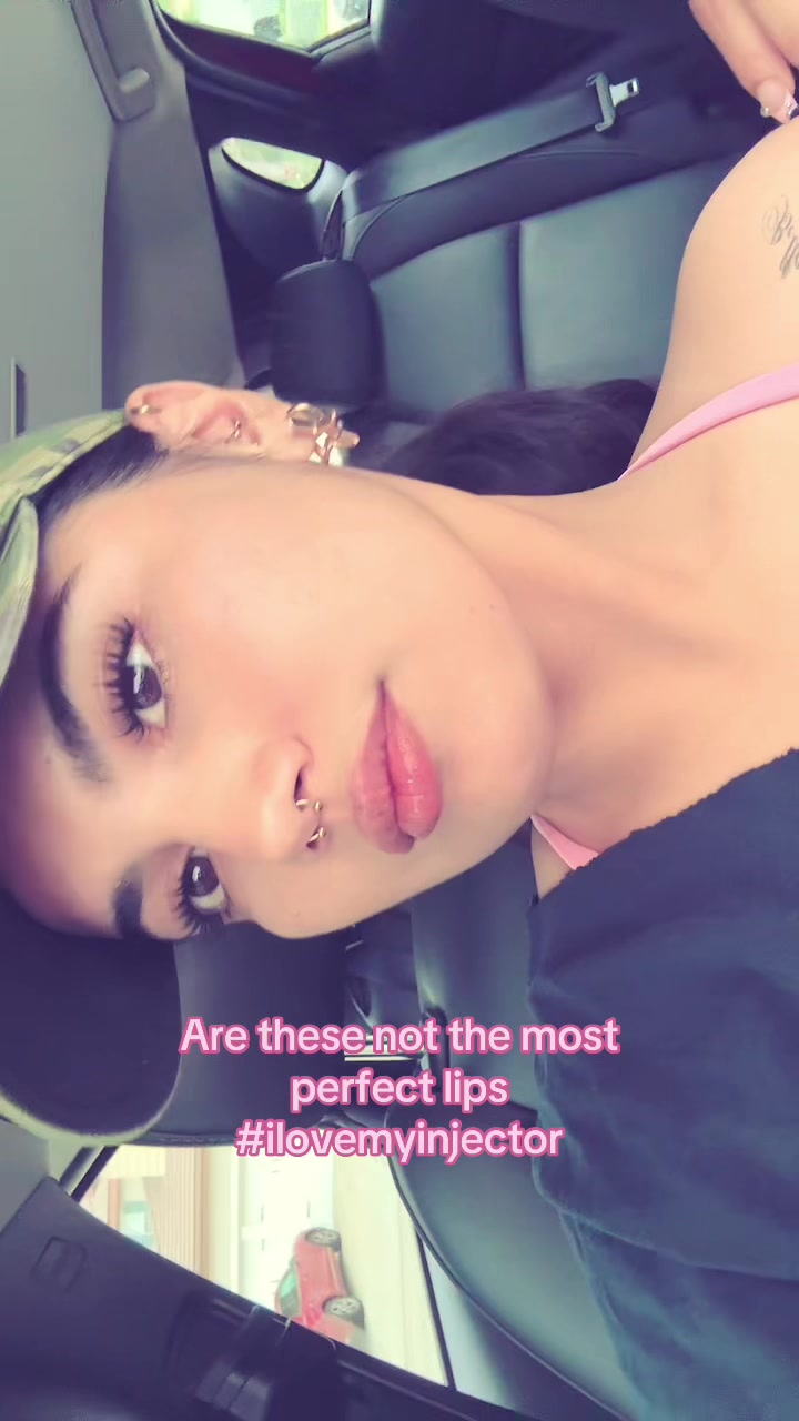 @Aowie