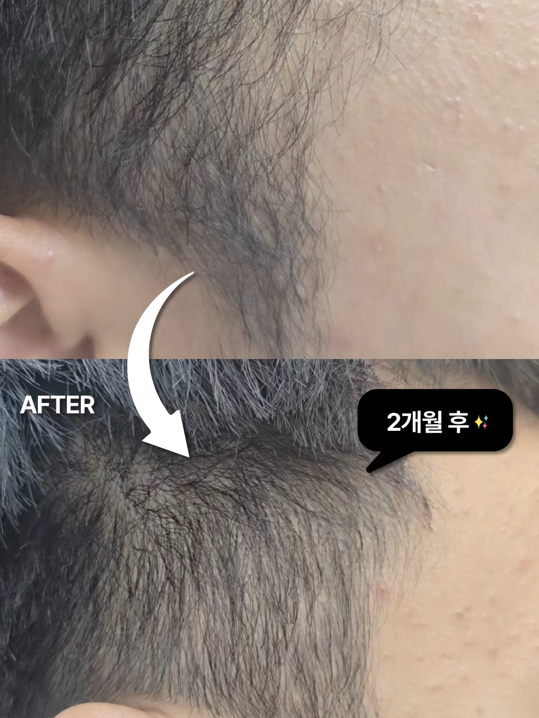 @EDDY BEAUTY KOREA