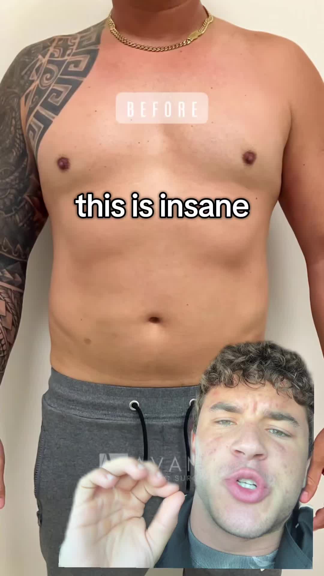 @fonz