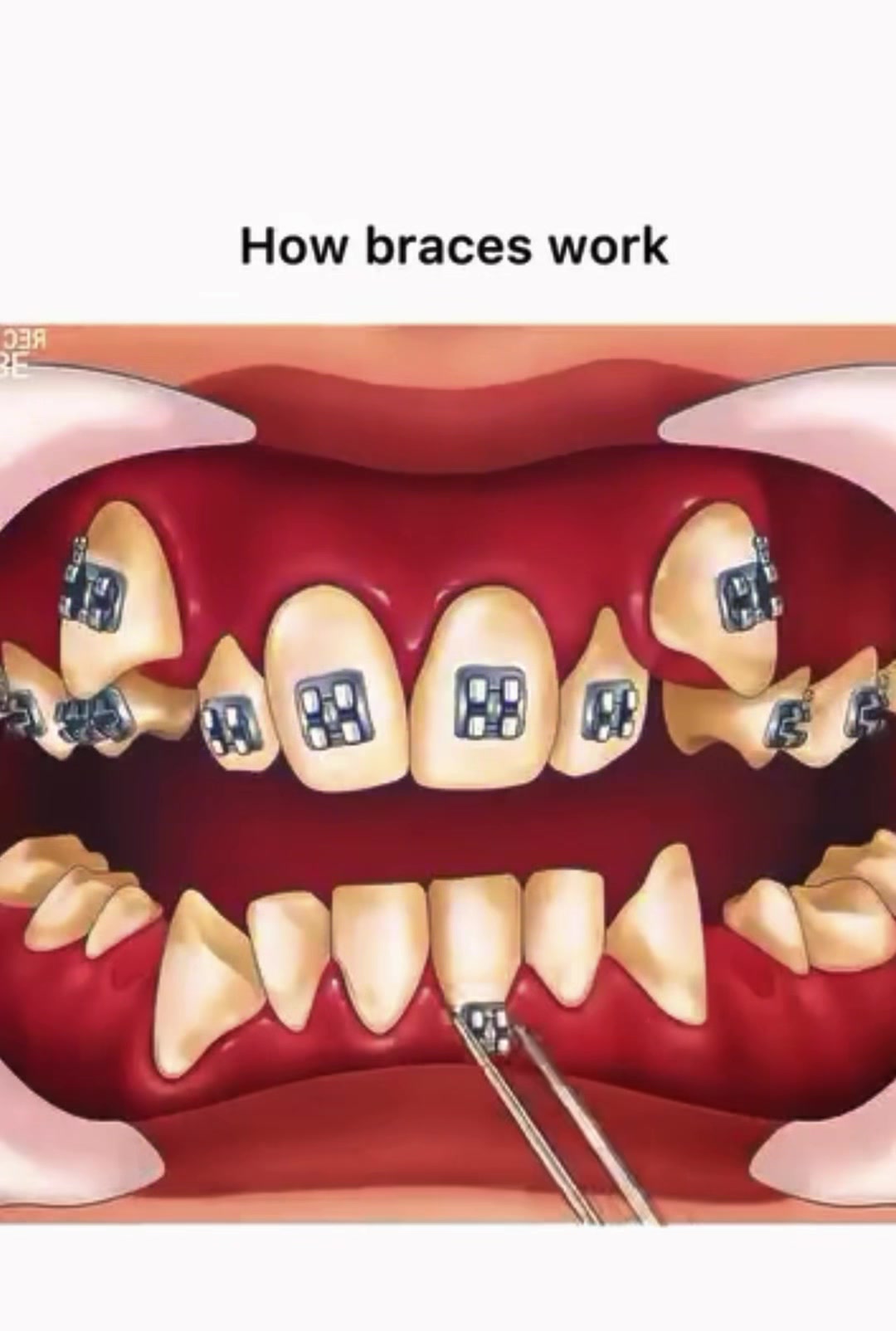 @Aᴇsᴛʜᴇᴛɪᴄs & Dᴇɴᴛᴀʟ Wᴏʀᴋ's🦷