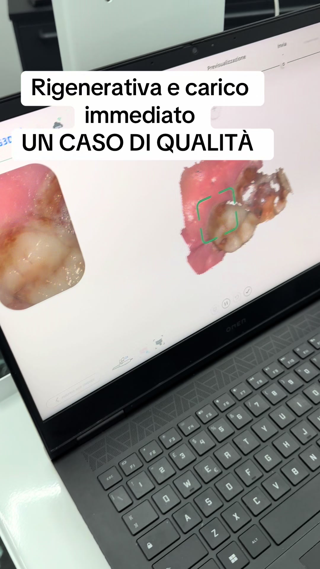@Dott.RaffaeleNegro 🦷