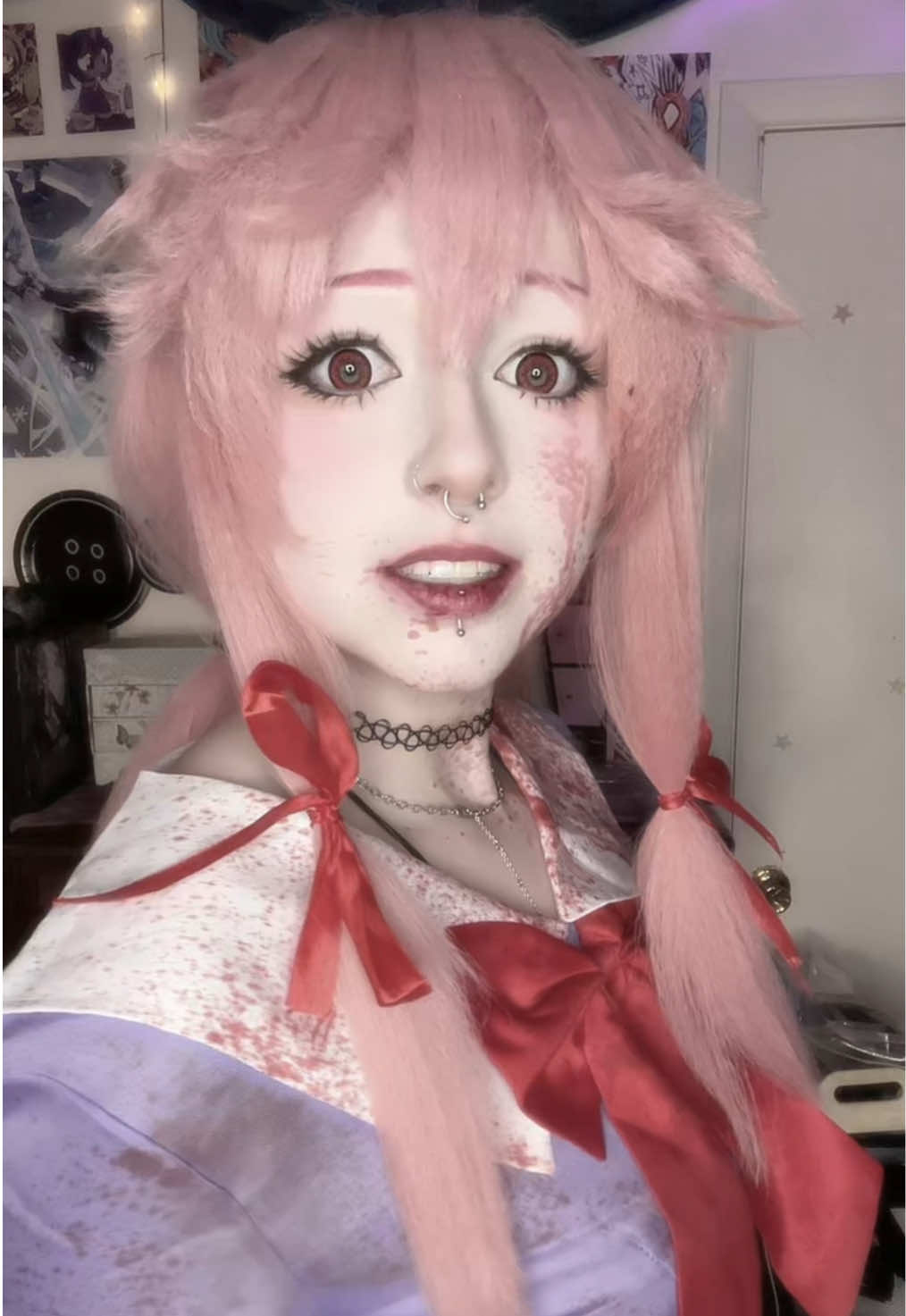@Xoe