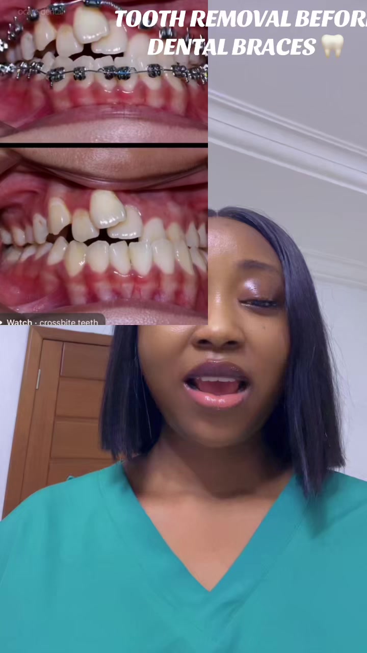 @NurseVivinelle_OralEducator🦷