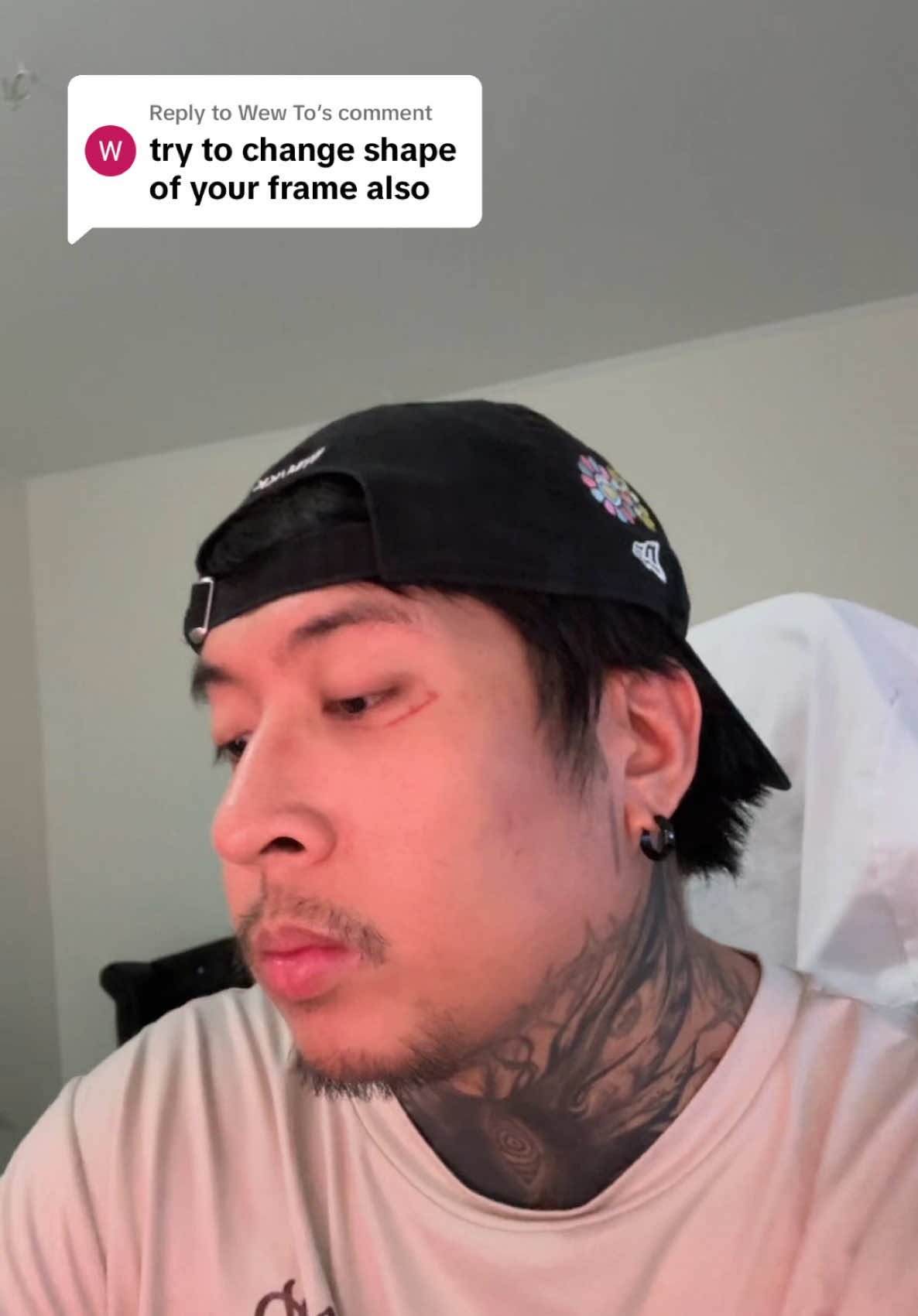 @Anthony Leodones