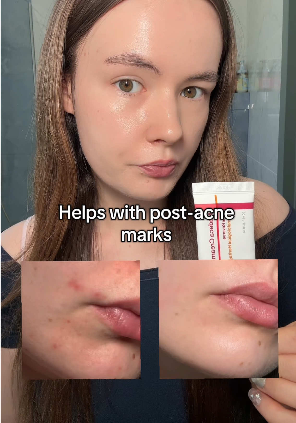 @watermelonsugarskin