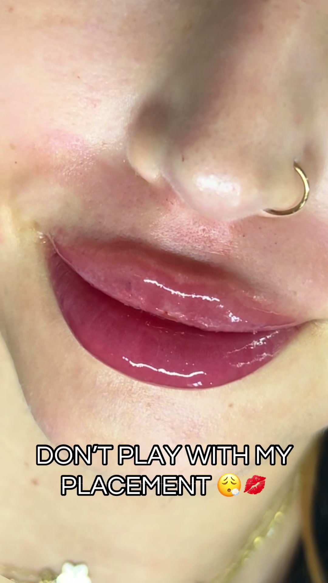 @injectormami