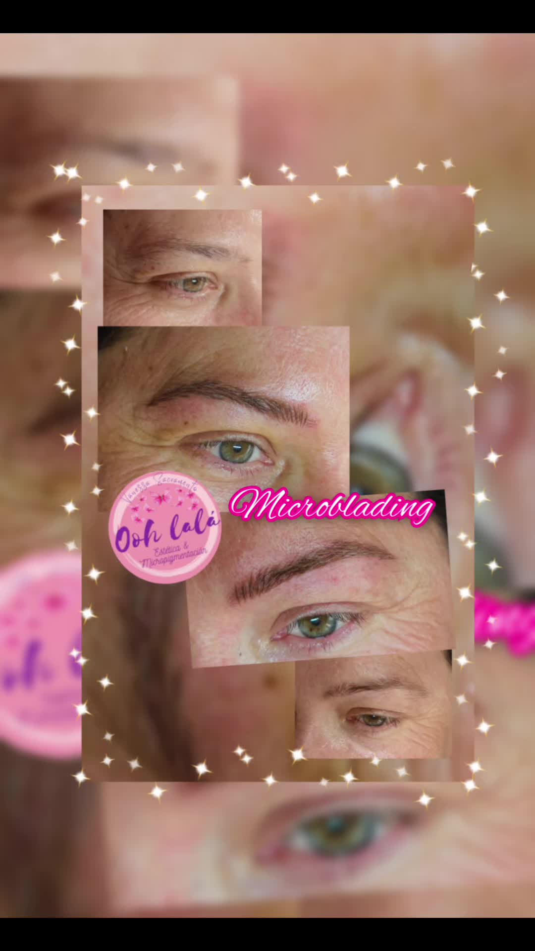 @Oohlal&aacute; Est&eacute;tic