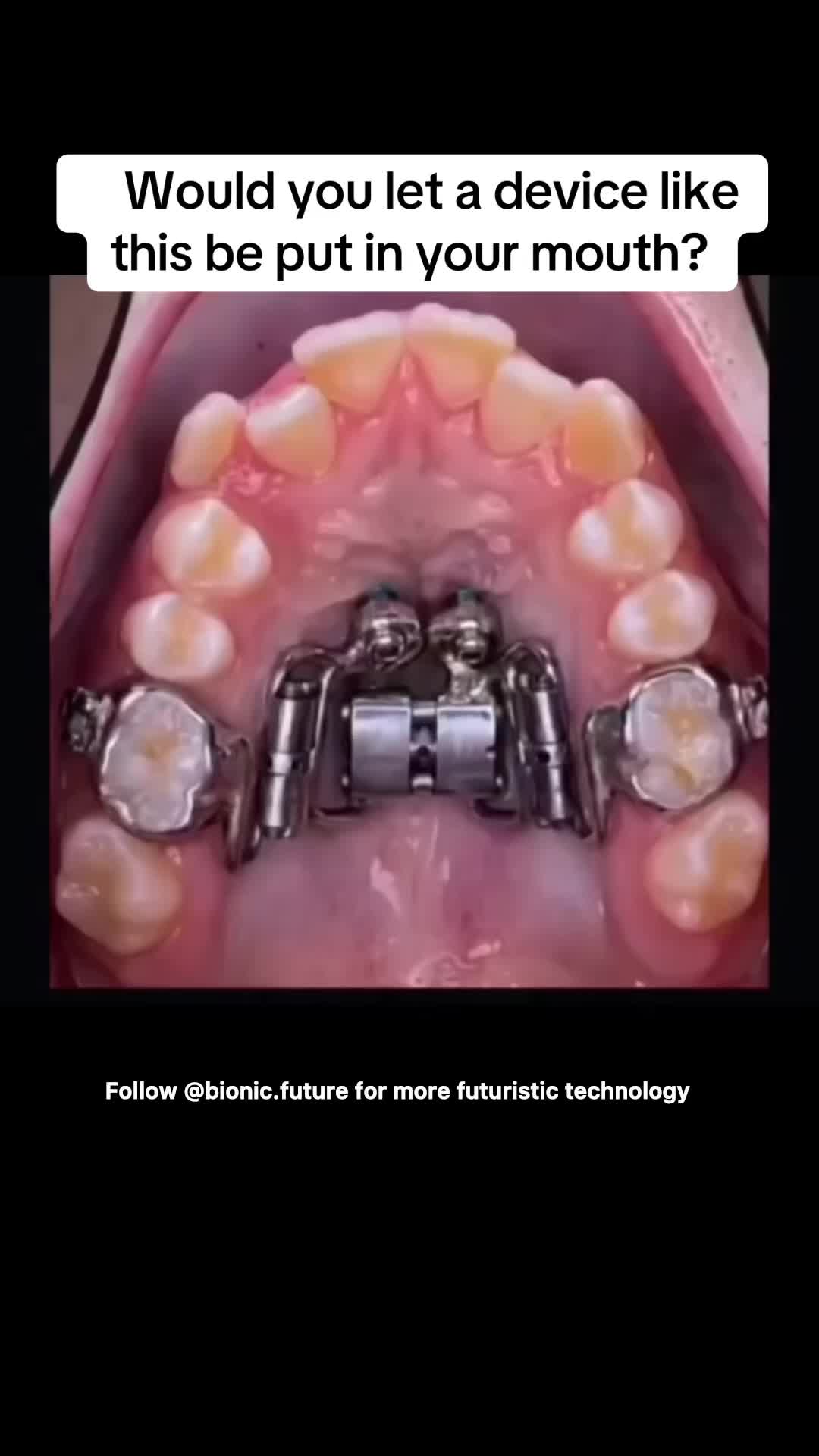 @bionic.future