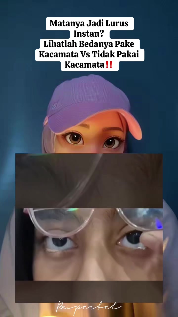 @B U P E R