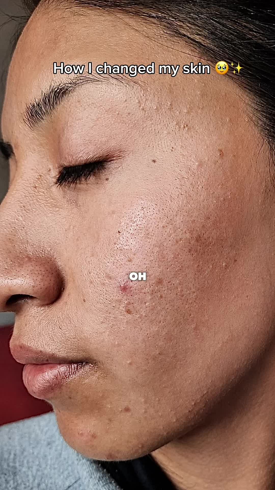 @linnagym