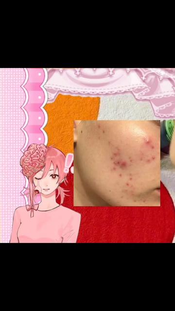 @Yoshikoi Σ(°ロ°)!!!