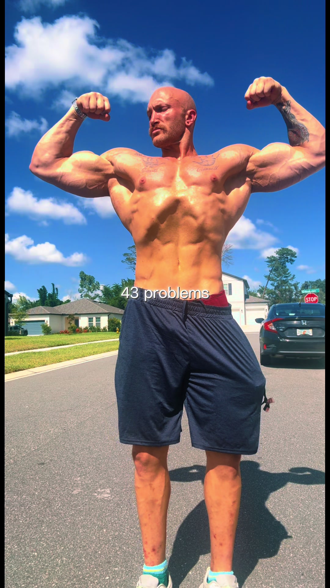 @Anthonythered