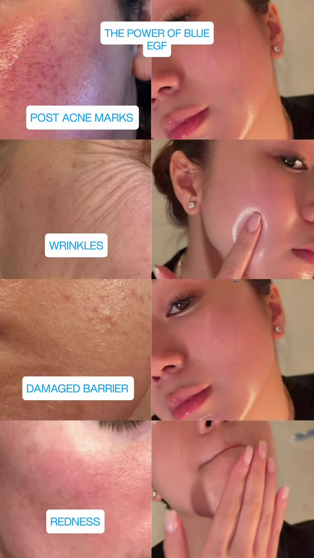 @Song Of Skin