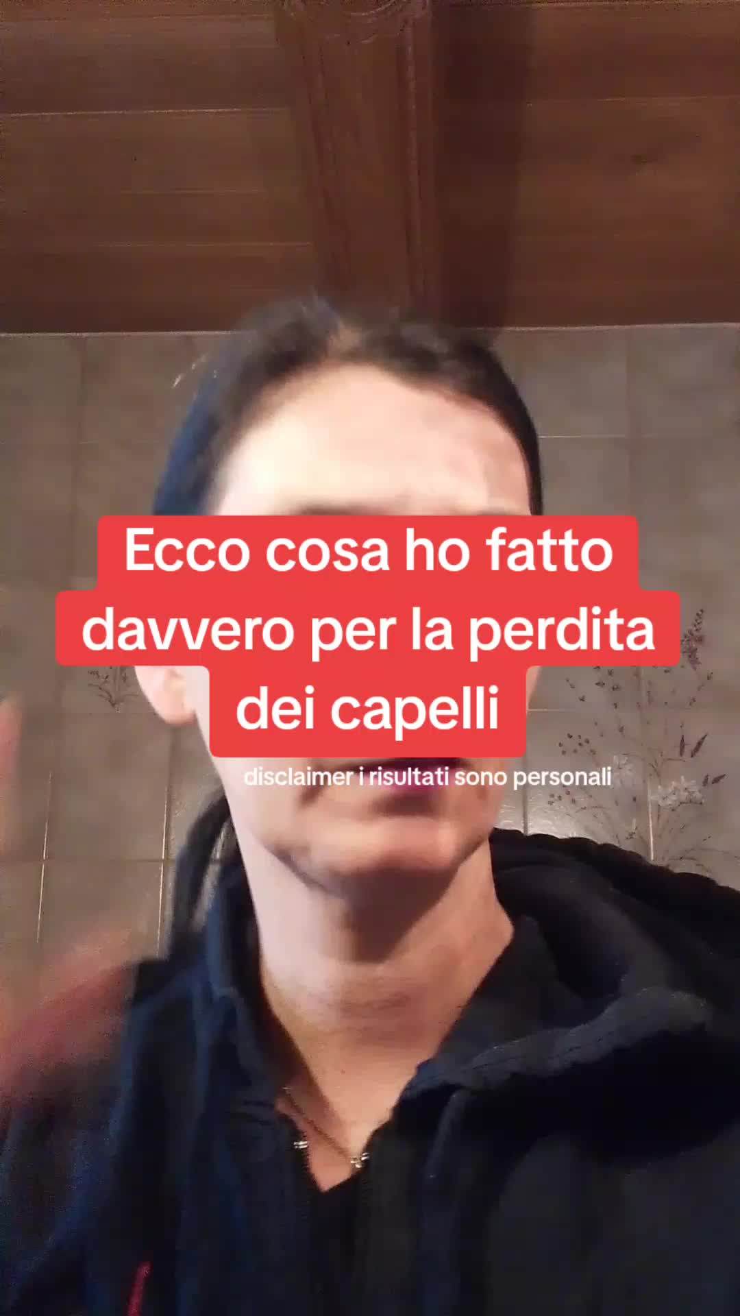@iry crescita capelli