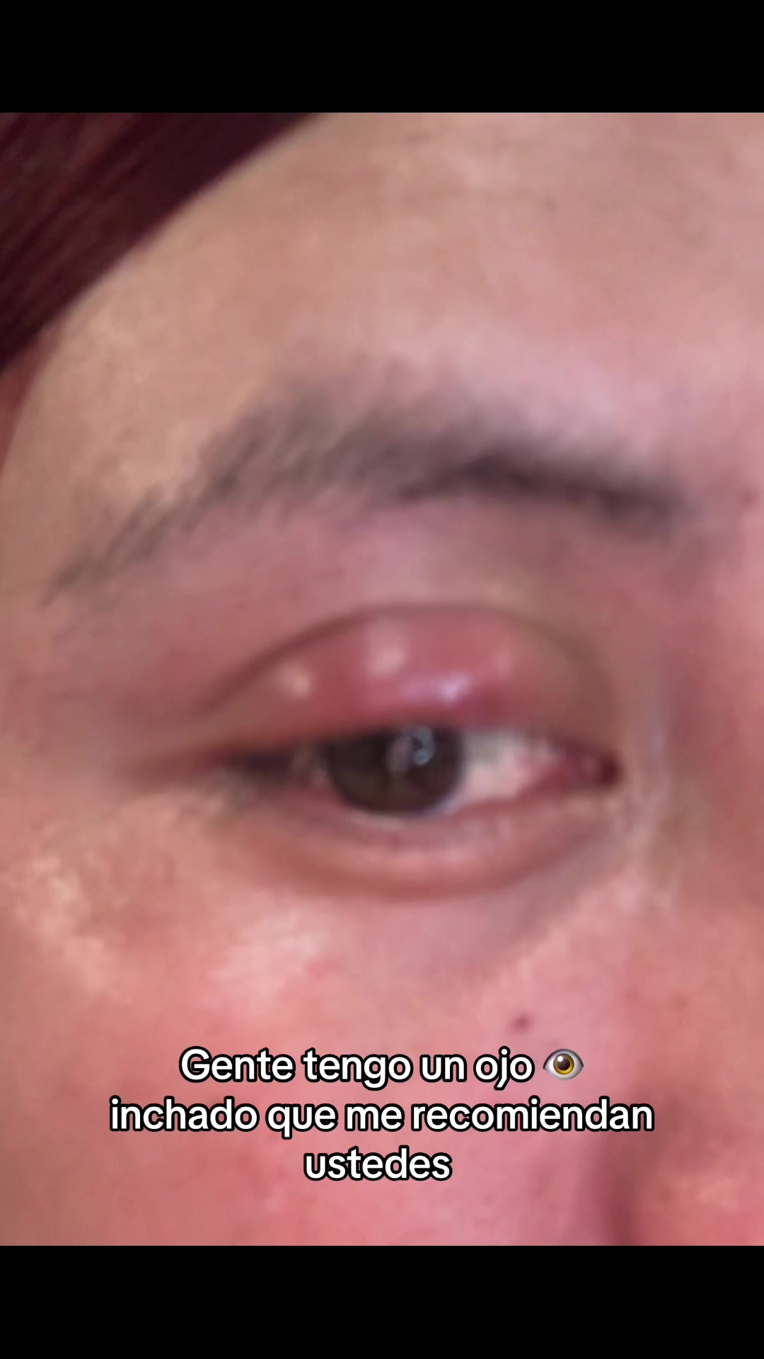 @Zamydeleon