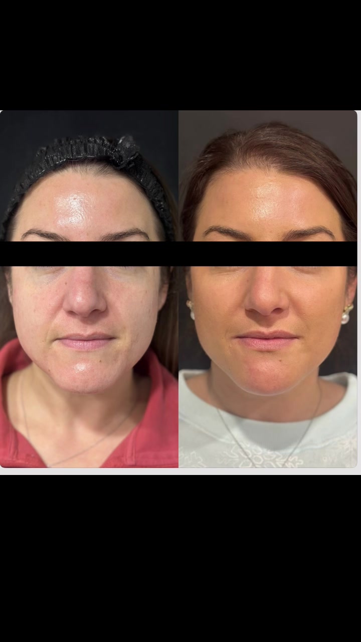 @injector.kate.ceccarelli