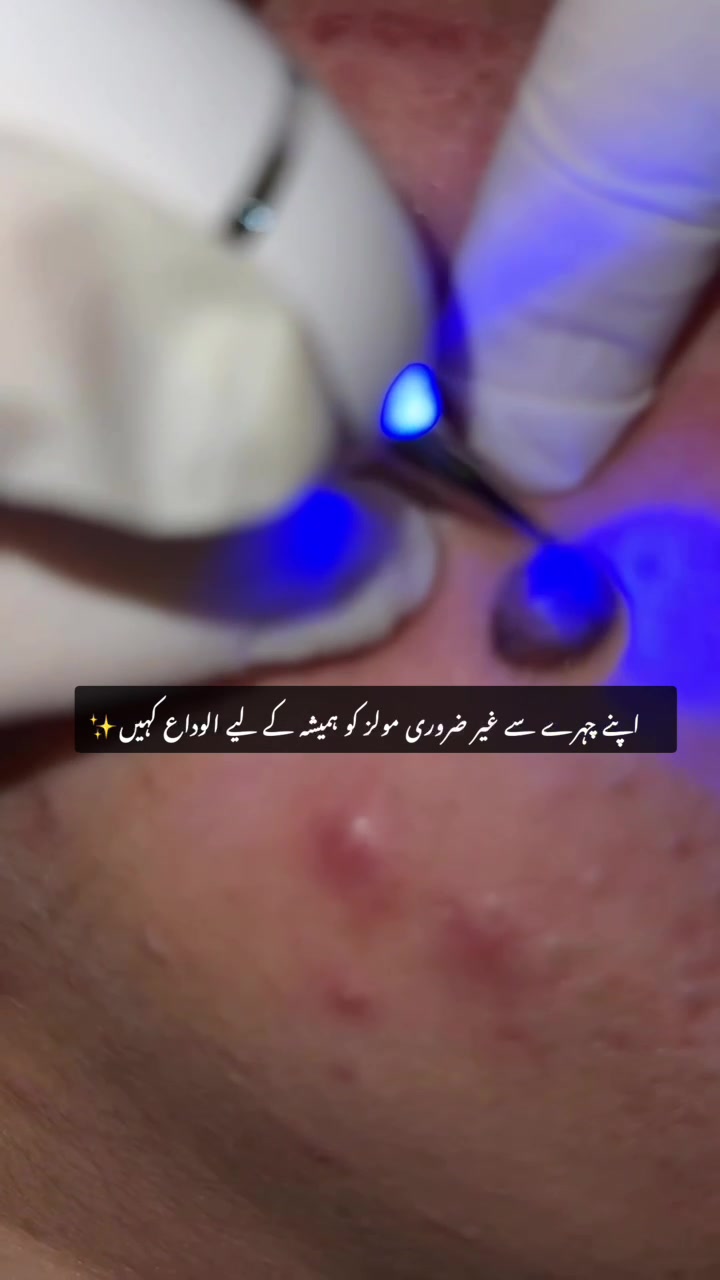 @City Aurora Asthetic clinic