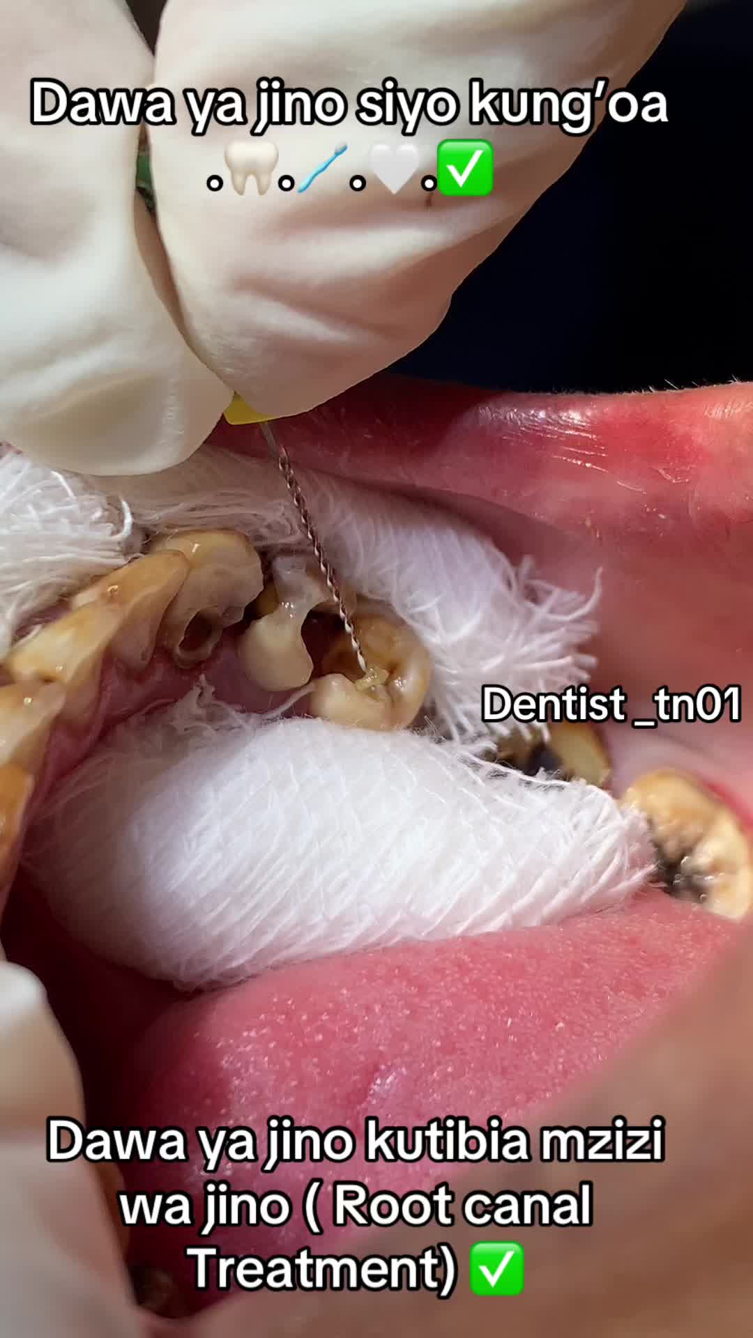 @Dentist_tn01