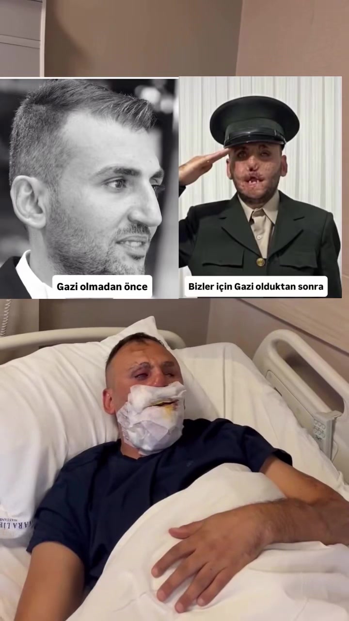 @Nice Yiğitler