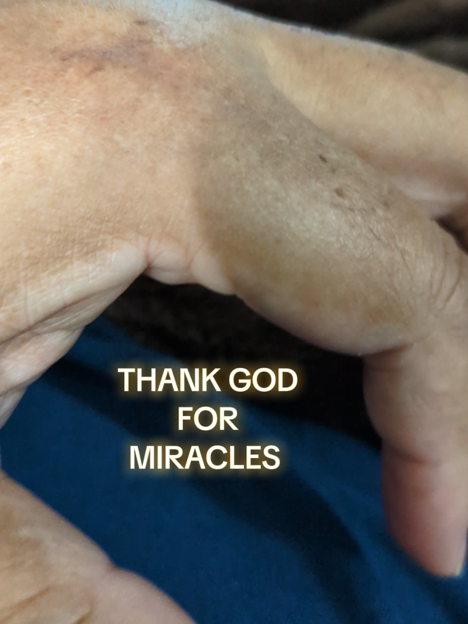@Stroke SURVIVOR Sal