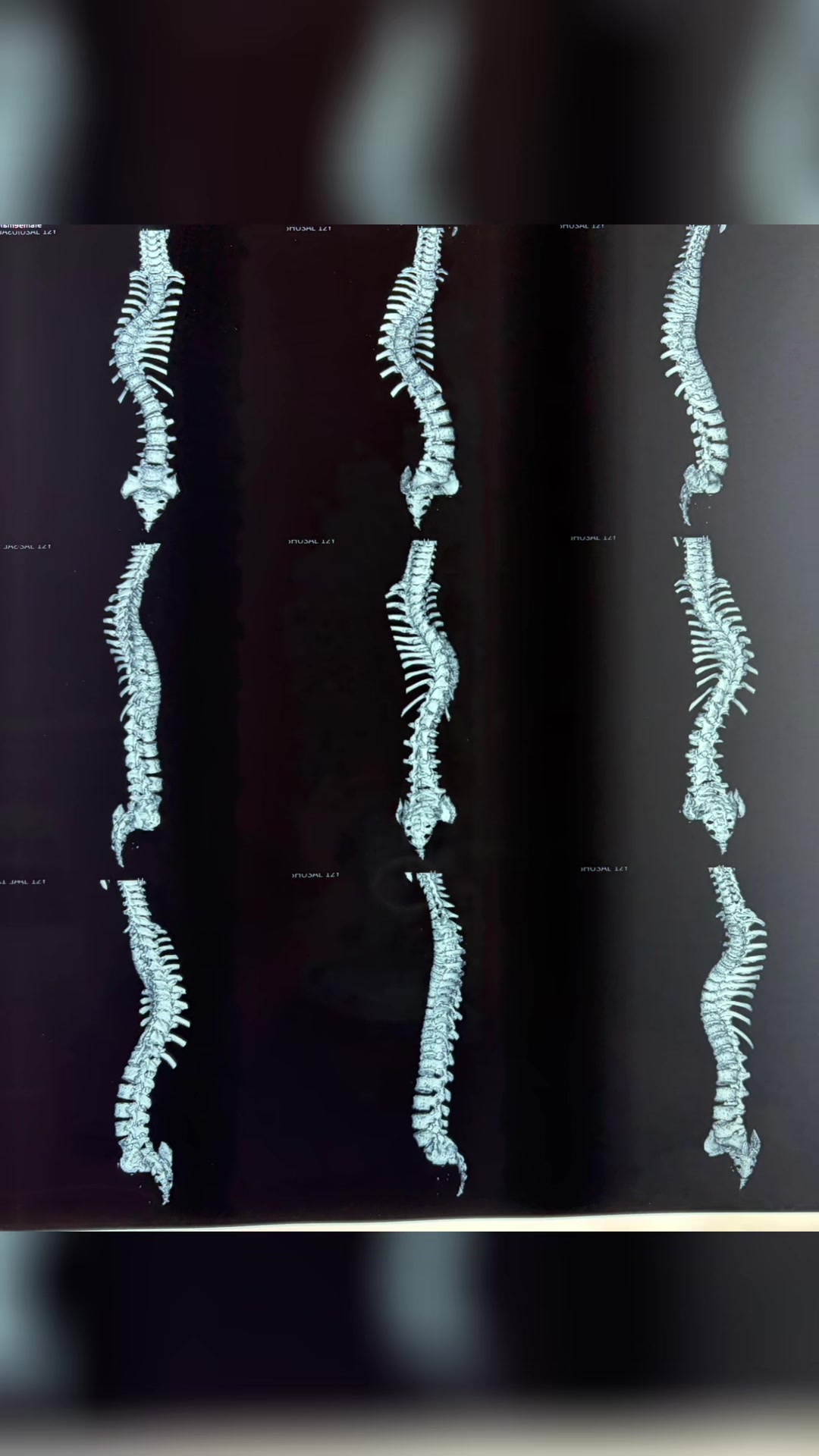 @Orthopedic_Surgeon_Arbind
