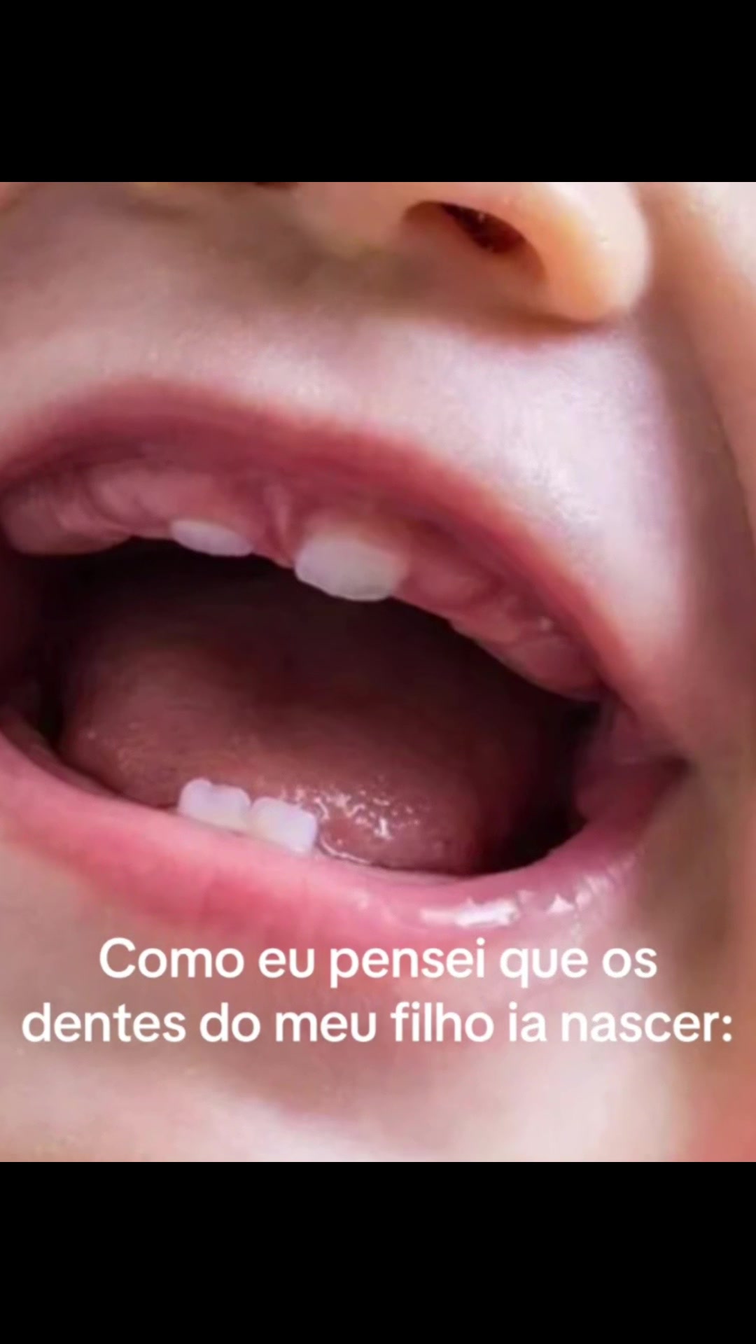 @-C๐ฅ