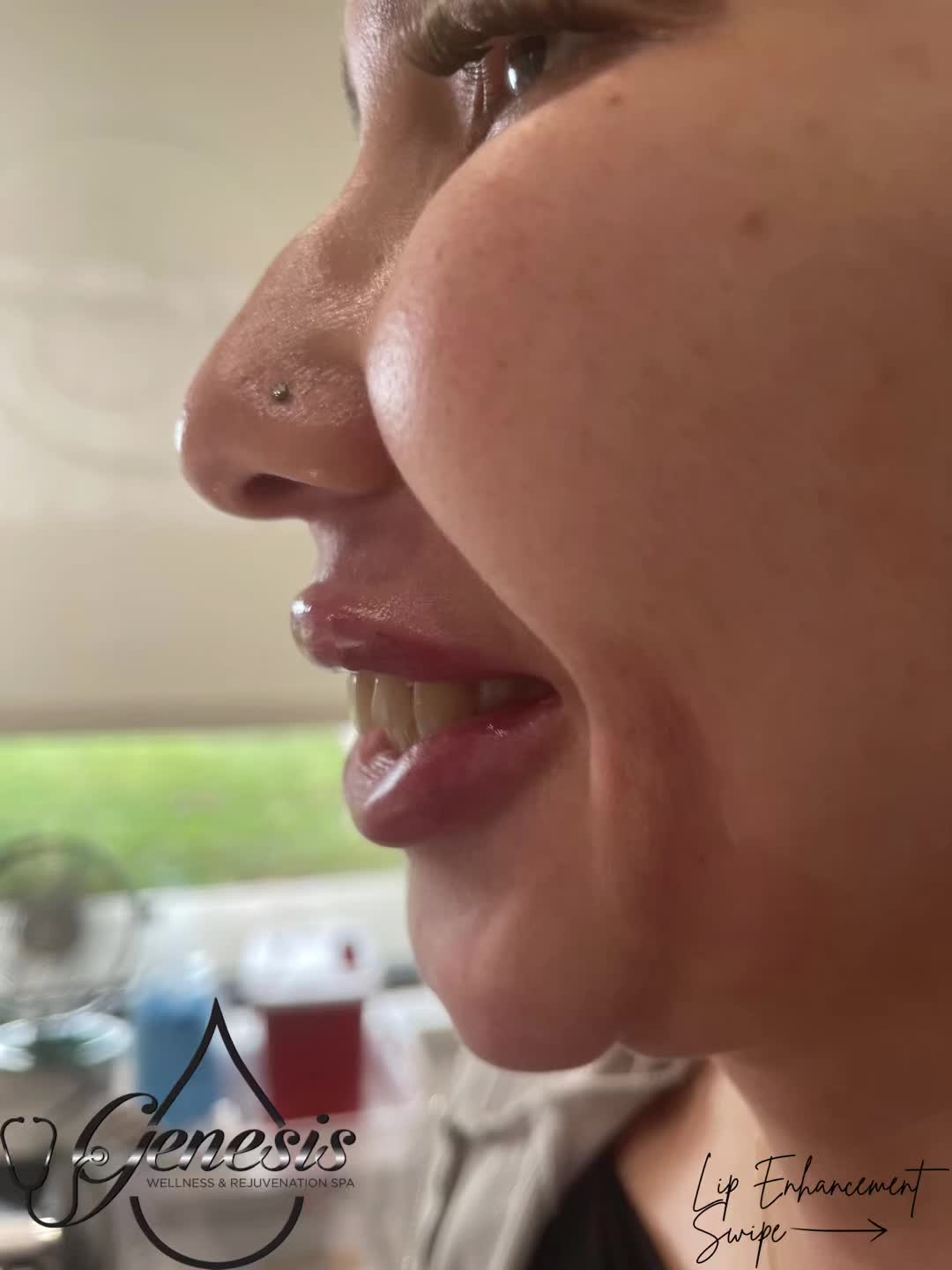@Genesis Spa