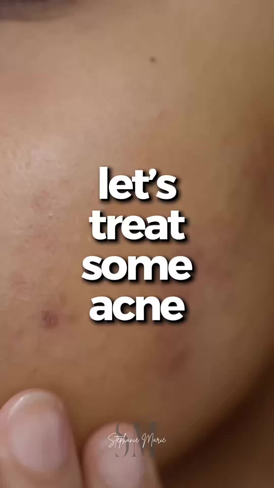 @EstheticsByStephH