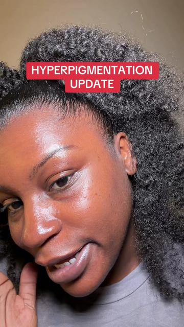 @Ebony✨Natural Hair & Fashion