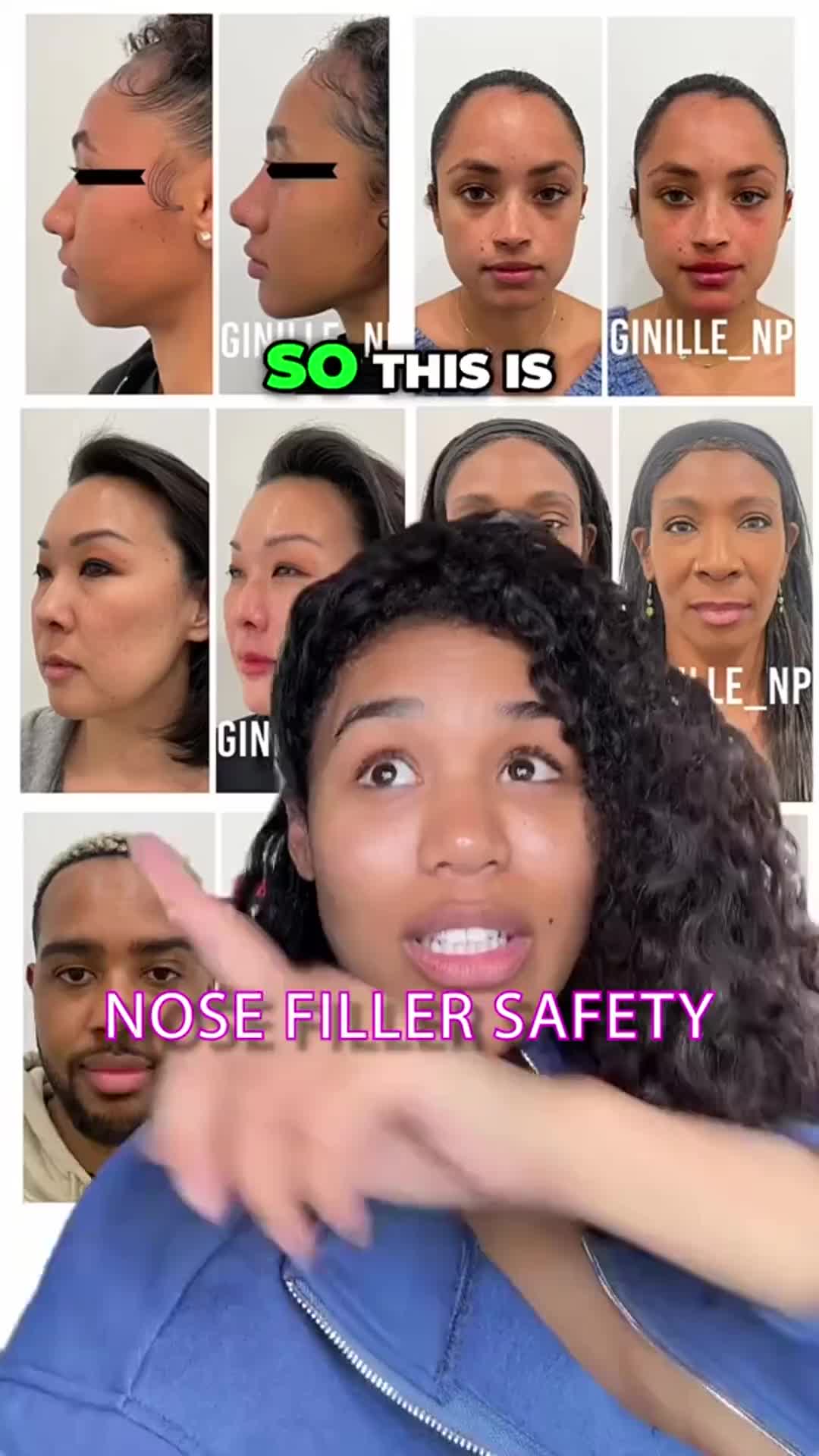 @Botox Filler Skin Los Angeles