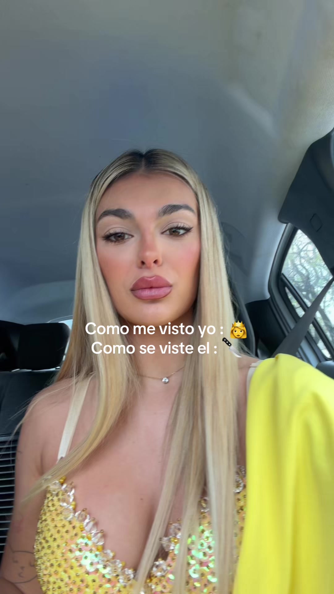 @Nenu Lopez
