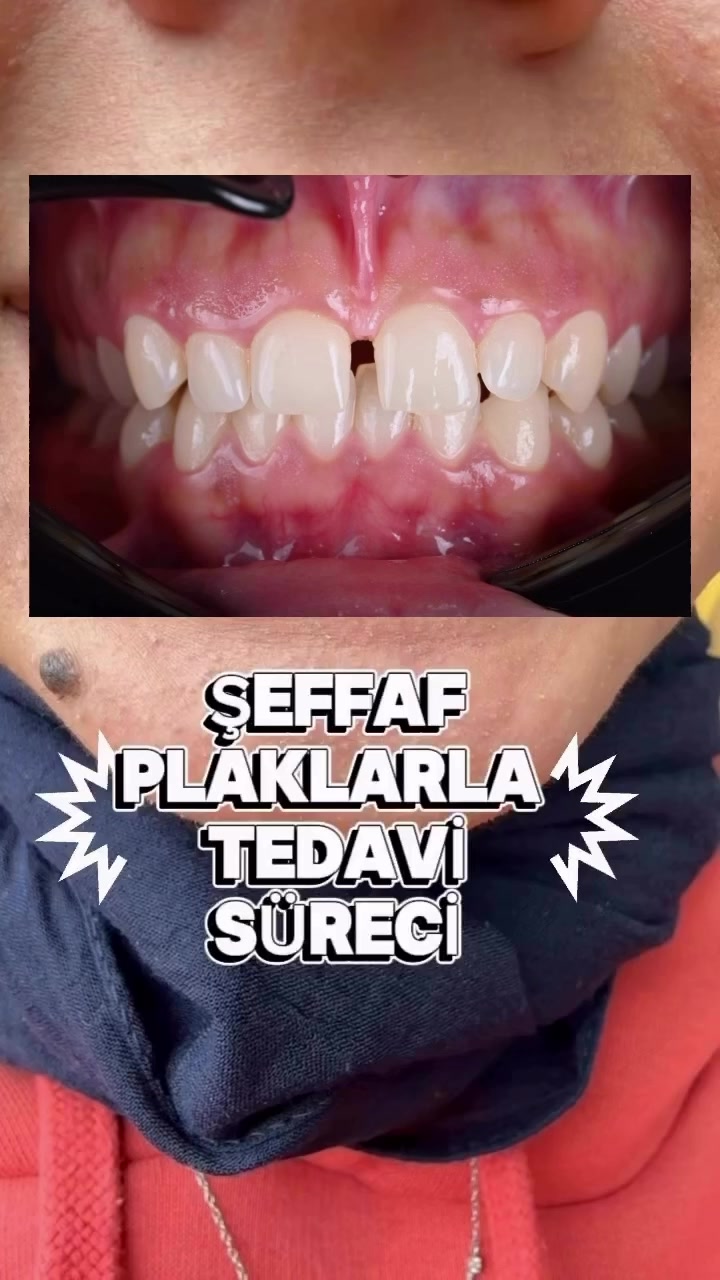 @Diş Hekimi Handenur Duru