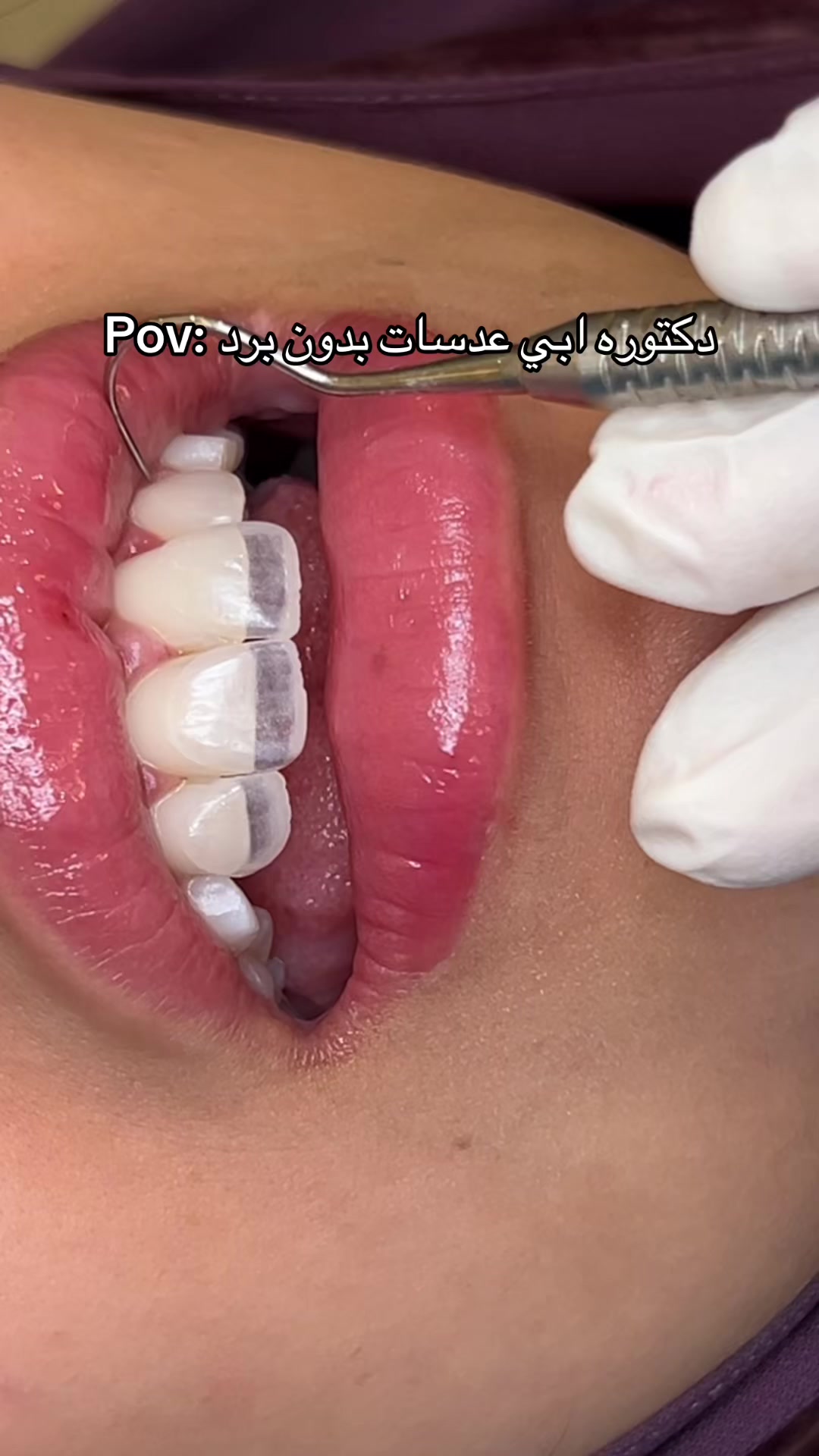 @Dr. Abrar Alhababi