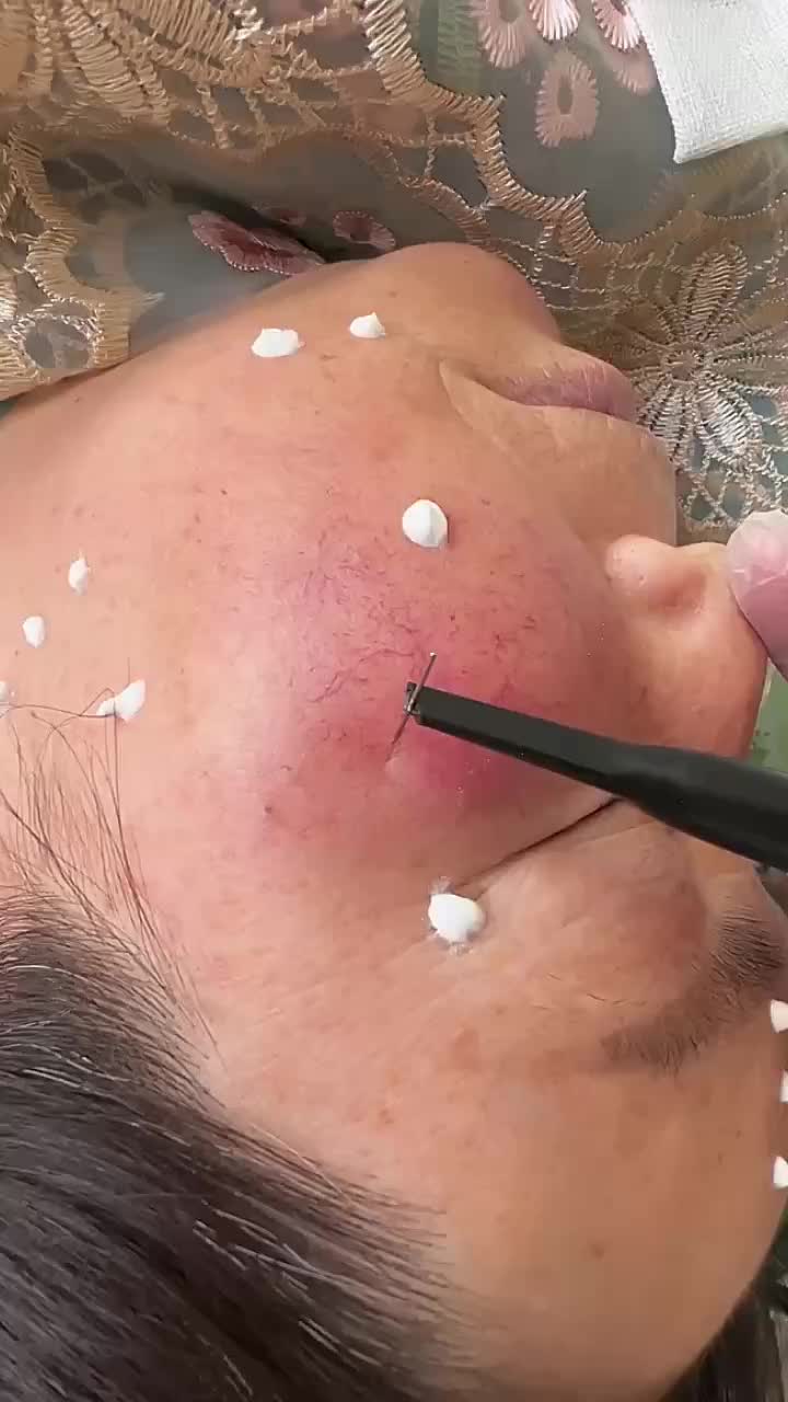 @Skincare Queen👑