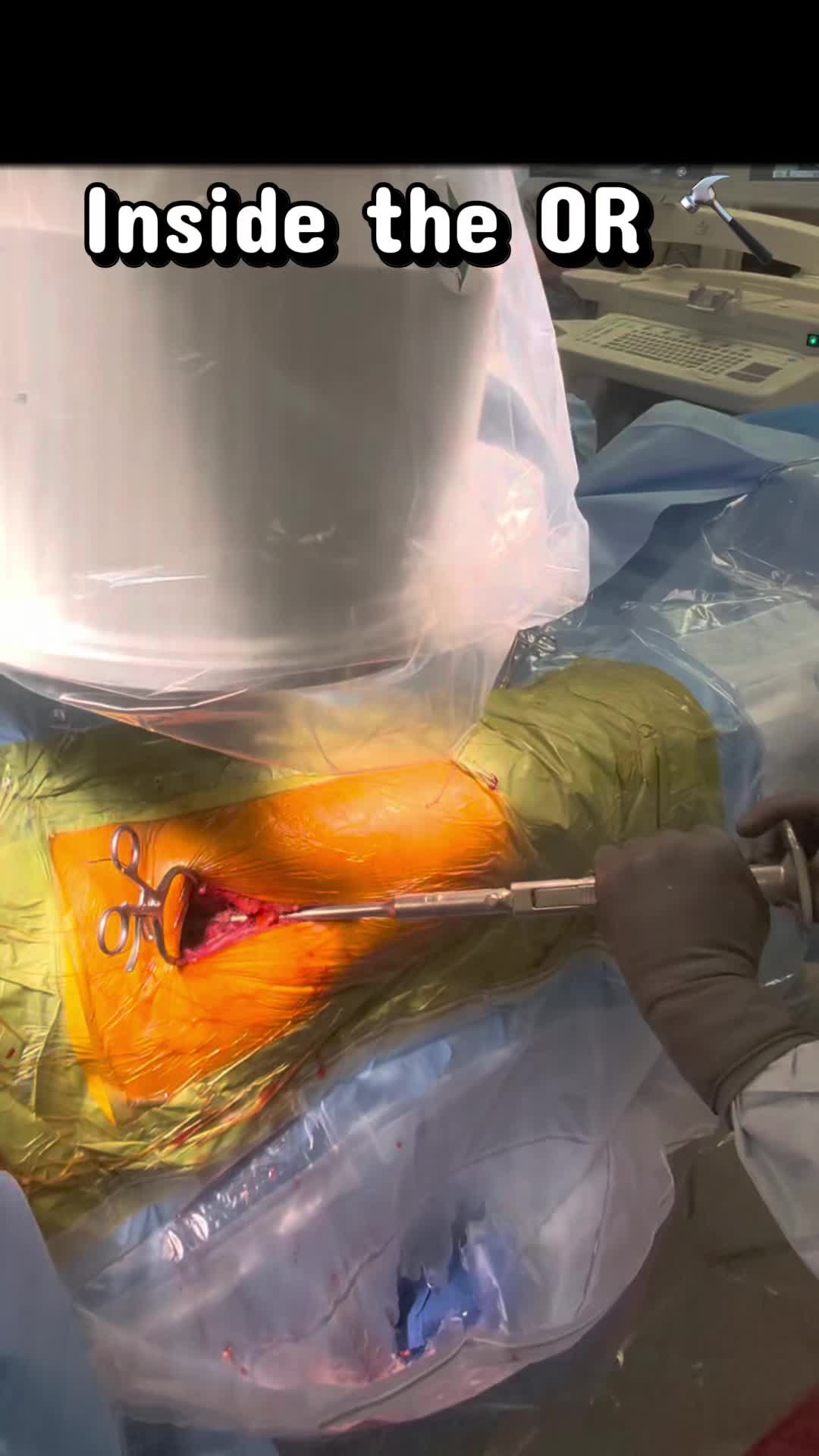 @Ortho POV