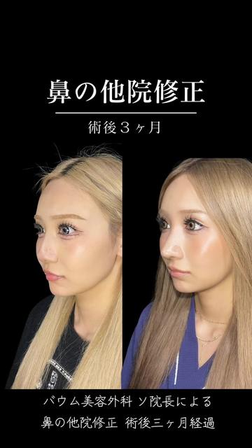 @ソ院長(バウム美容外科/トータル整形)