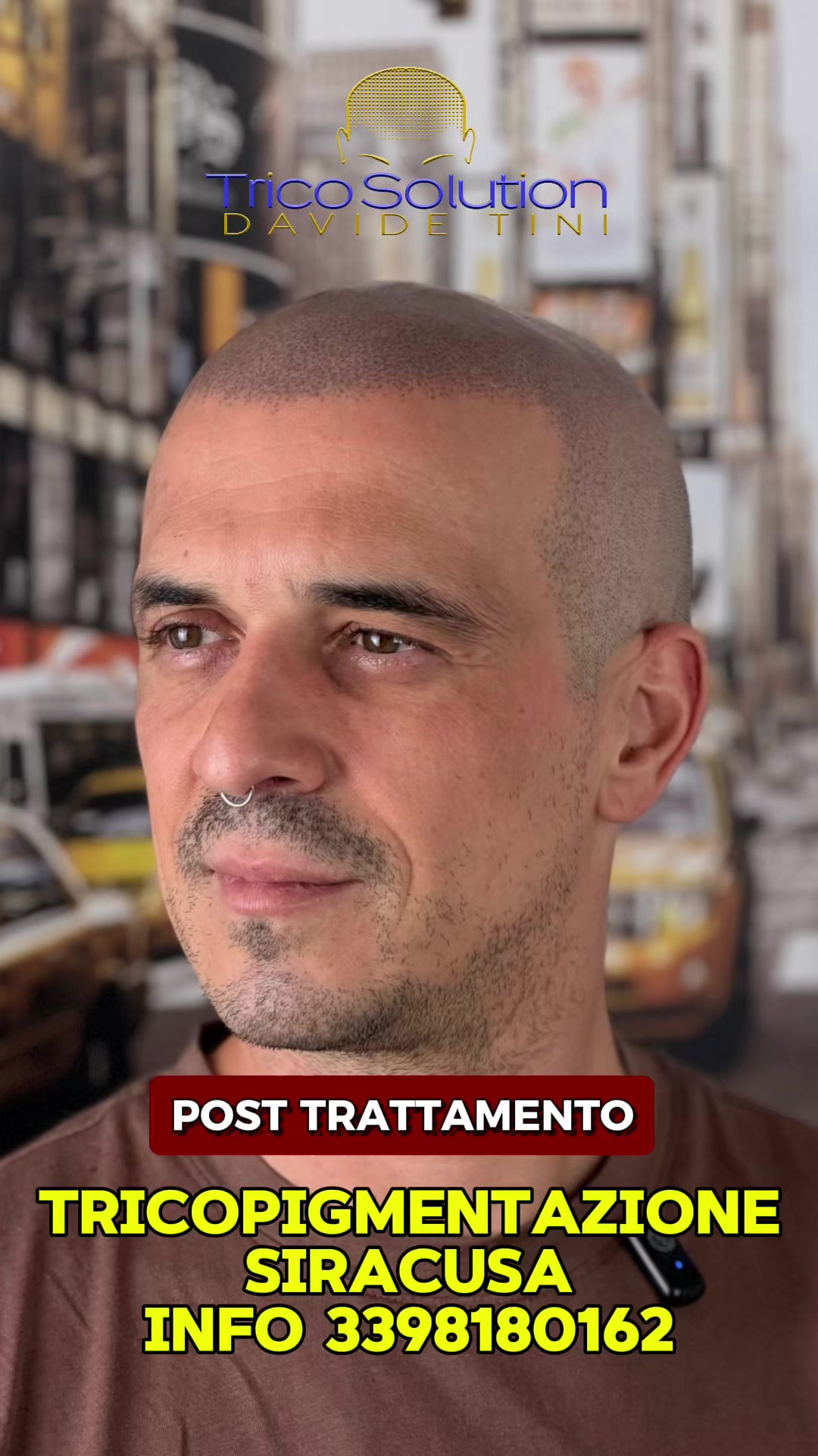 @TricoSolution di Davide Tini