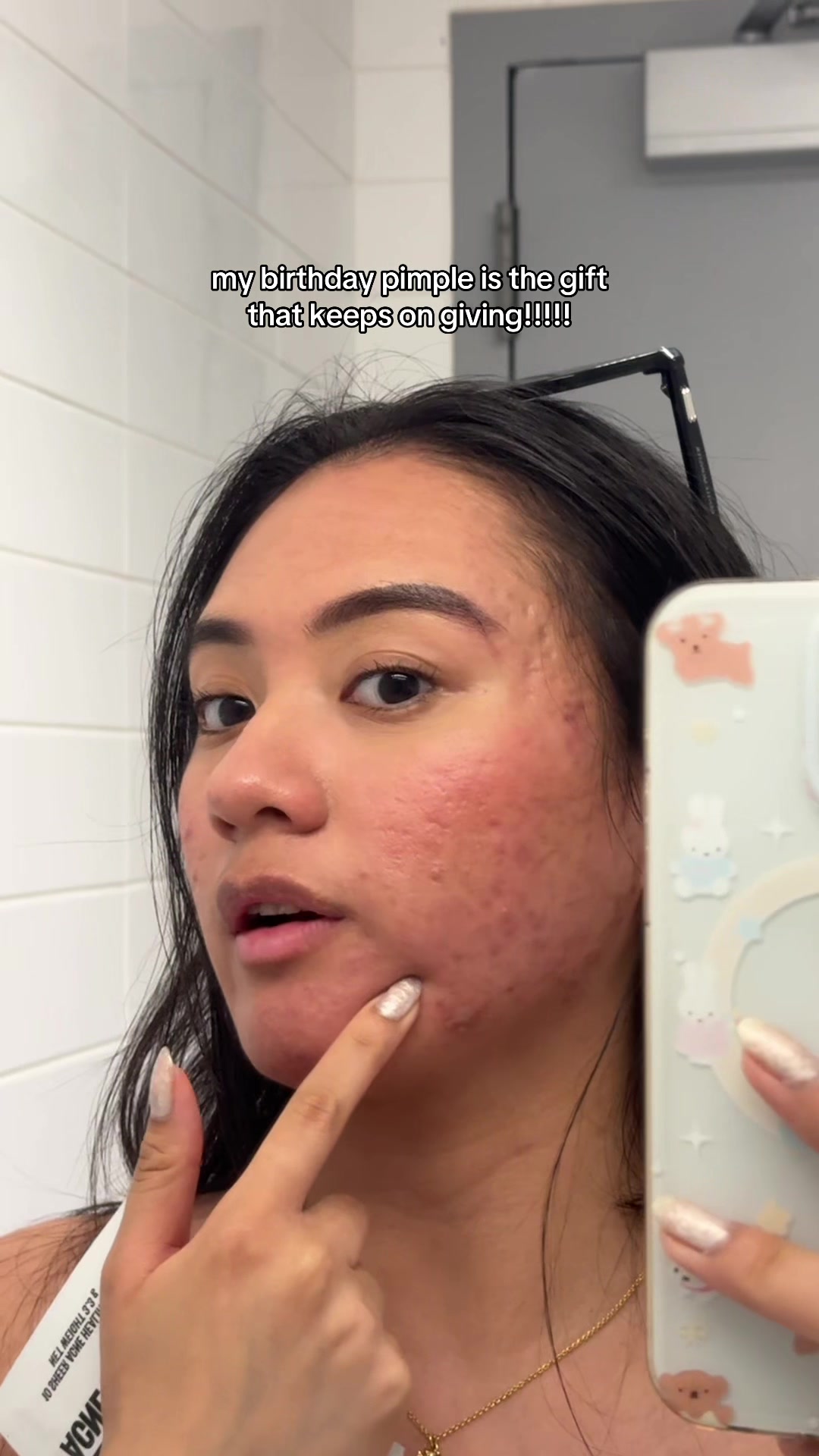 @jennilee &bull; thatacnegirlie