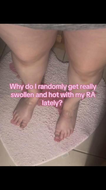 @RuthAnne