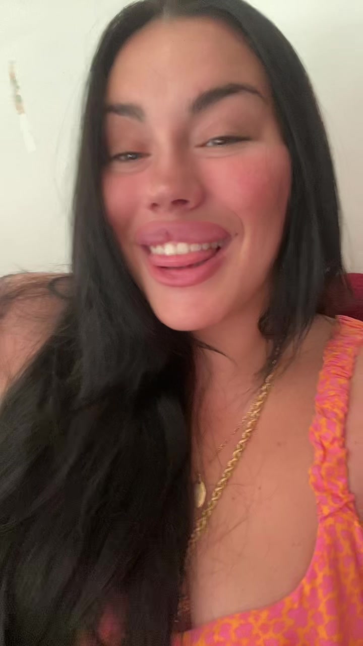 @Alessia albino