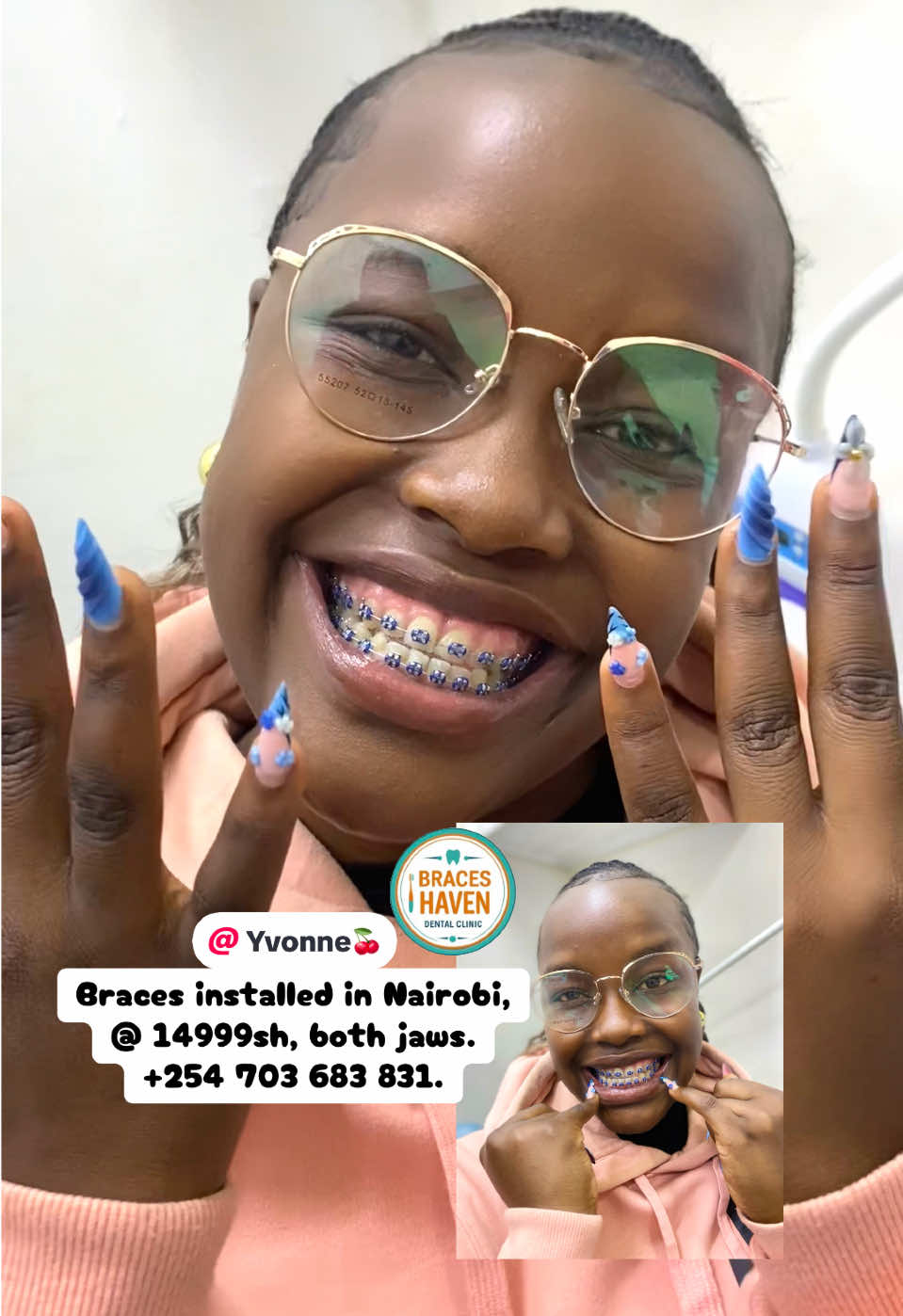 @Braces Haven Nairobi Dental