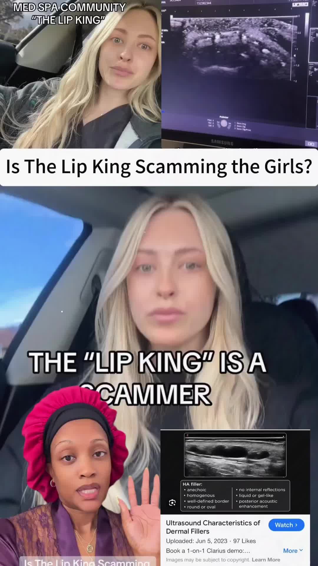 @fej