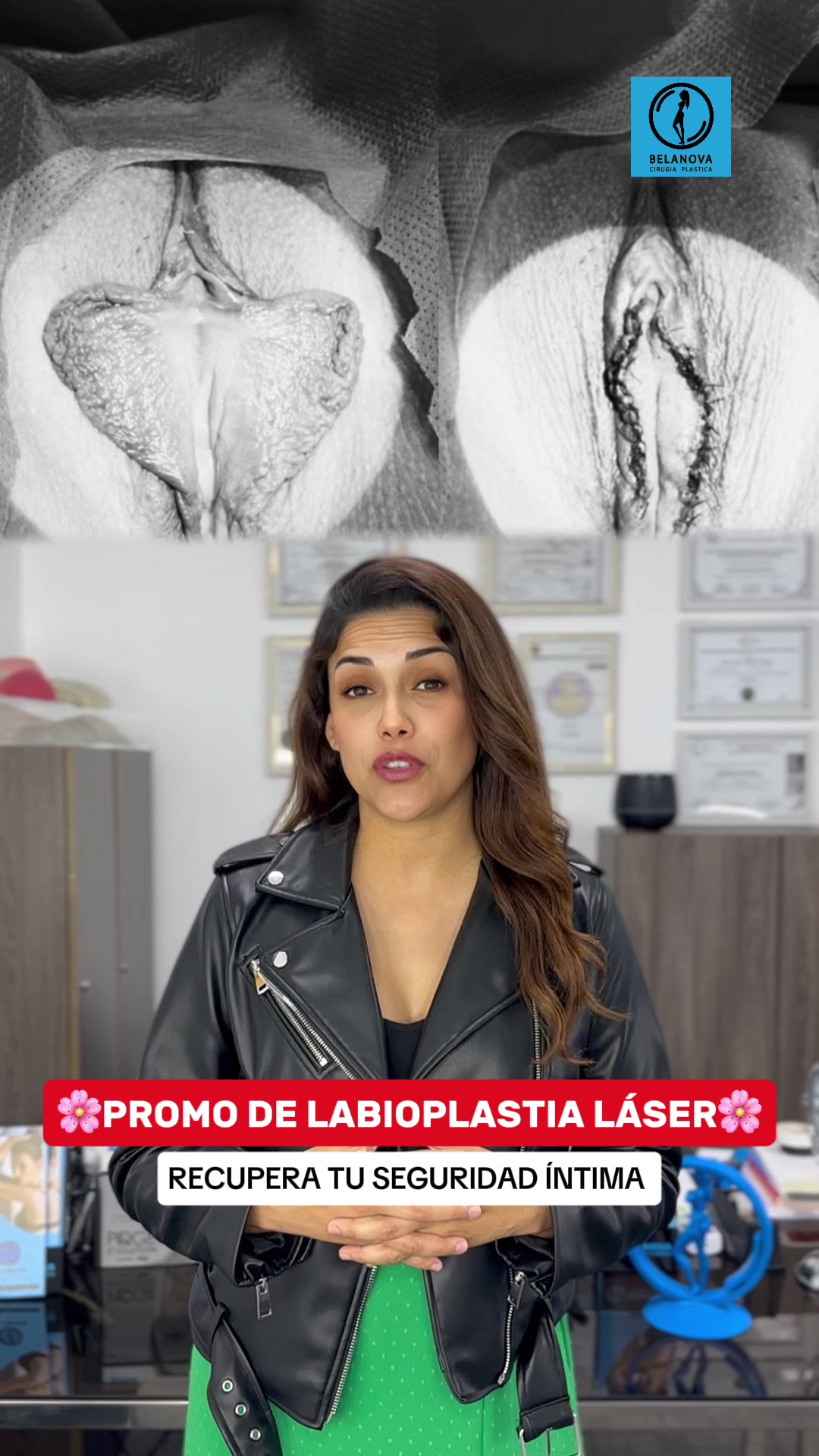 @Belanovacirugiaplastica