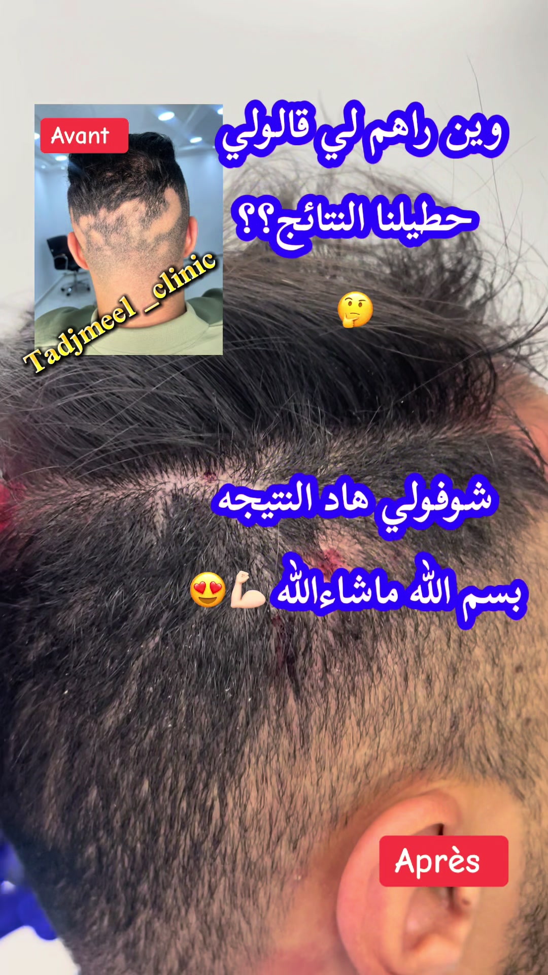 @TADJ Hair