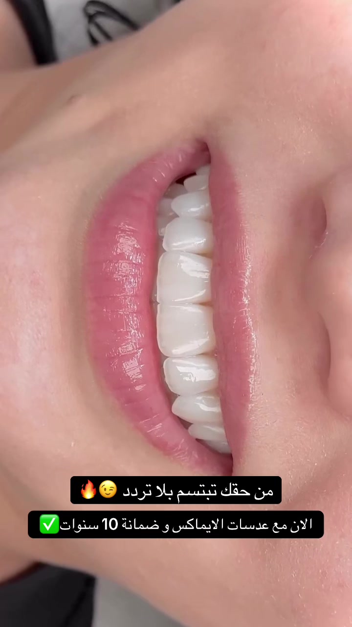 @brightsmileee1