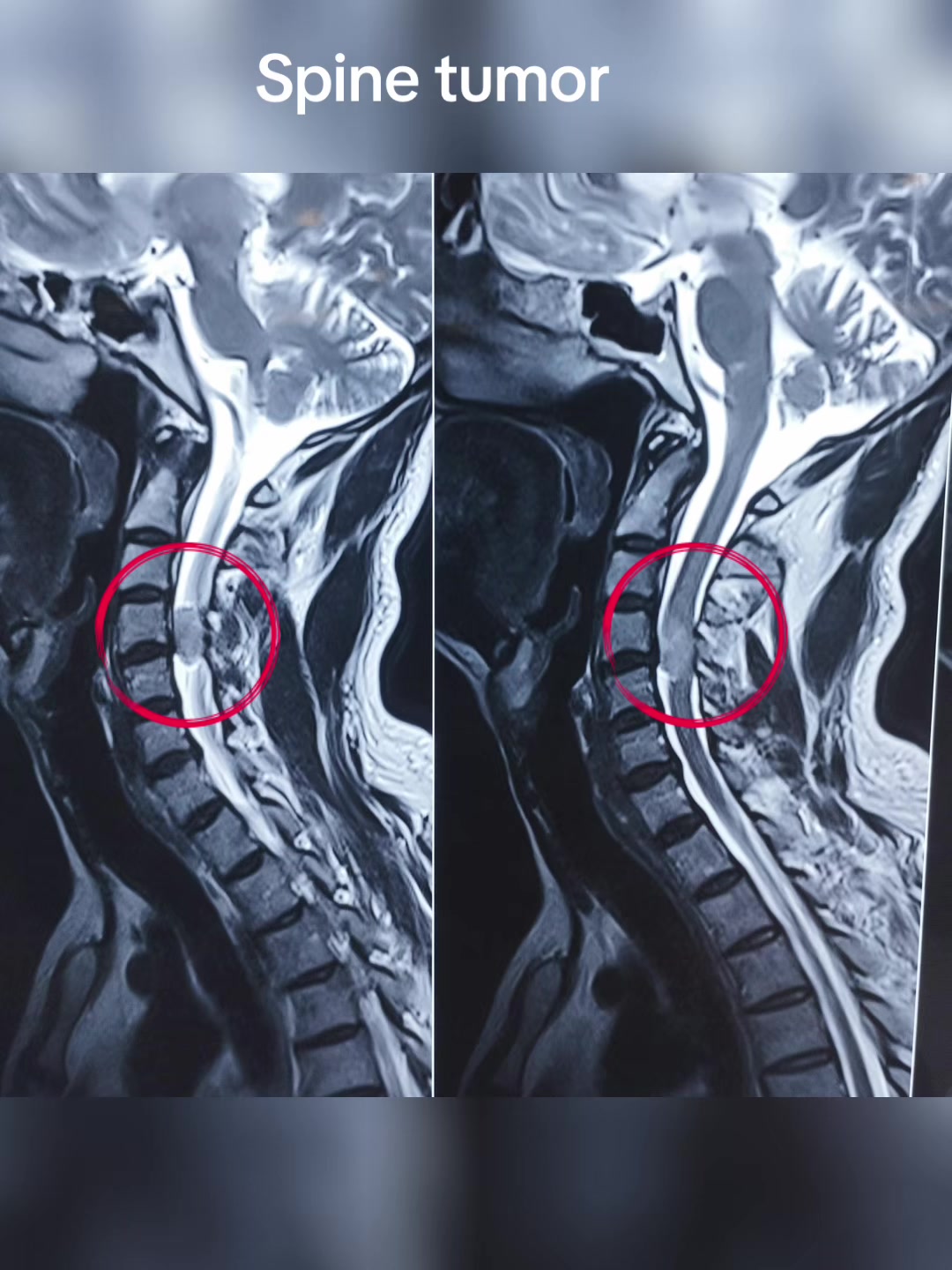 @Orthopedic_Surgeon_Arbind