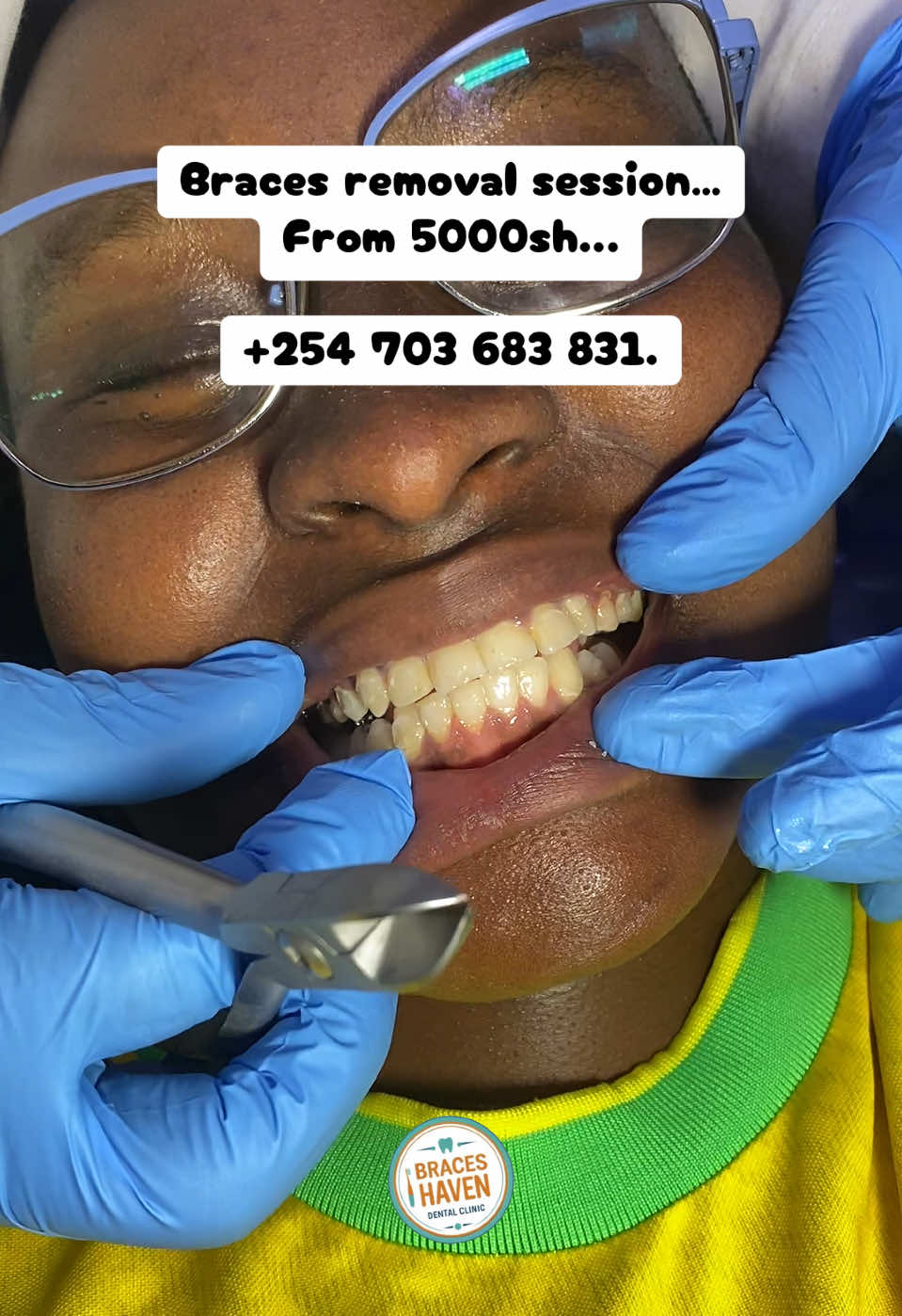 @Braces Haven Nairobi Dental