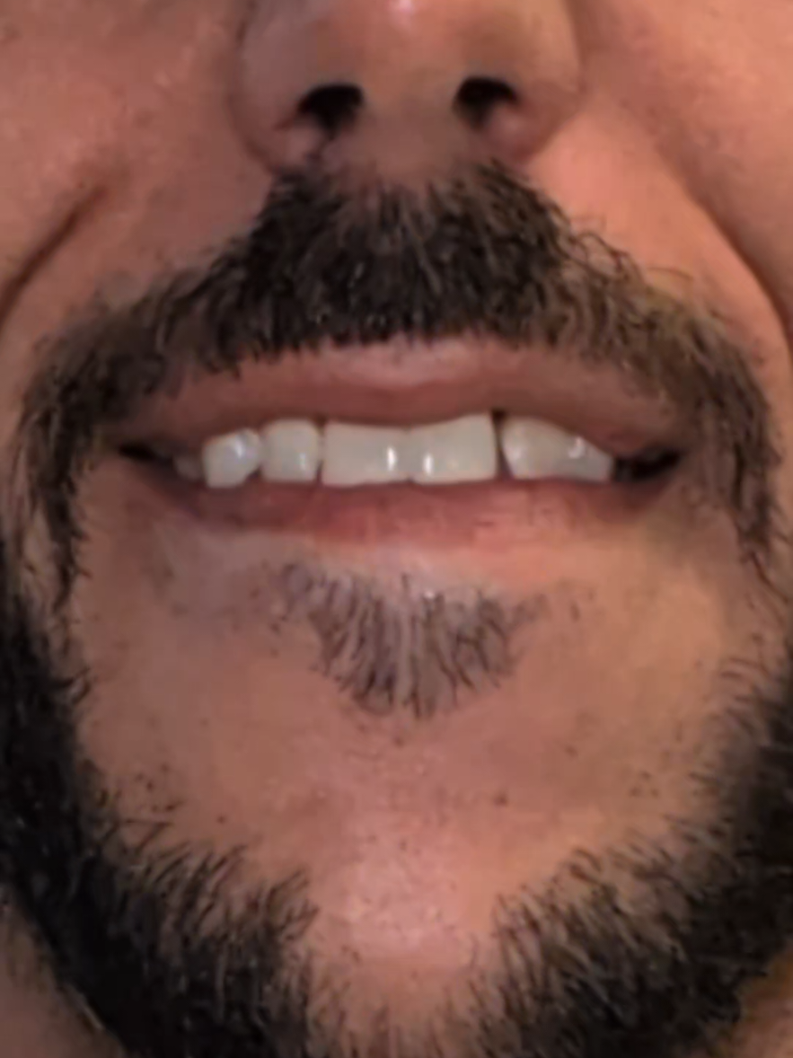 @DankeeDTV