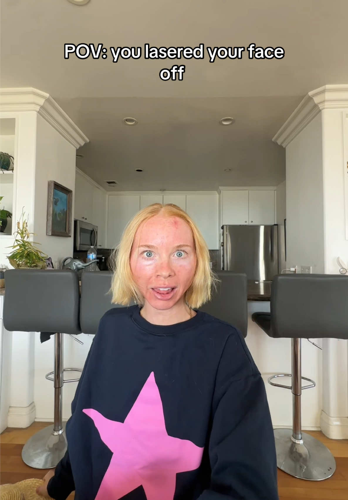 @Kirby_J